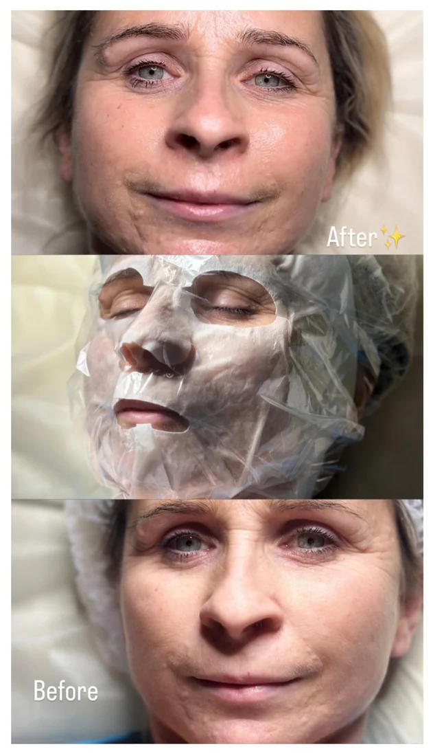 Historia regeneracji LED