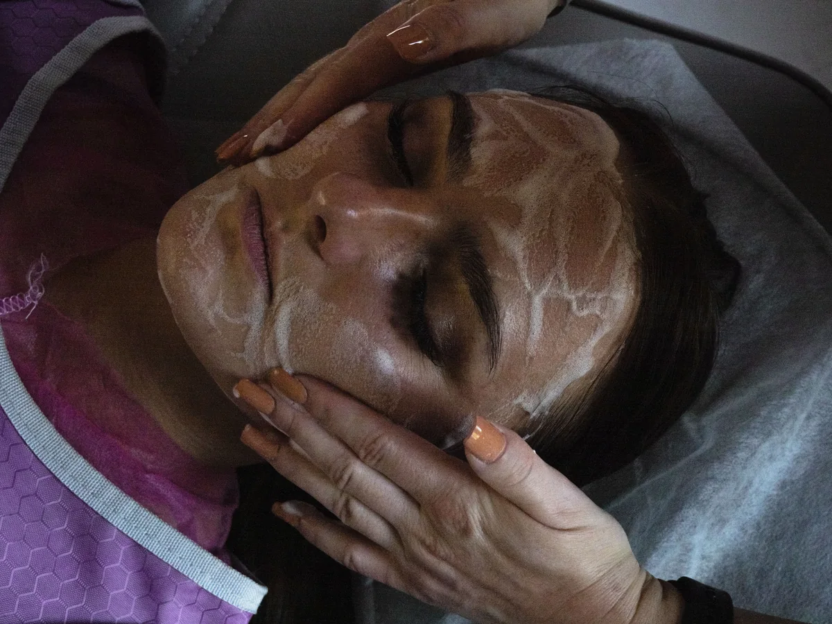 Peeling kawitacyjny
